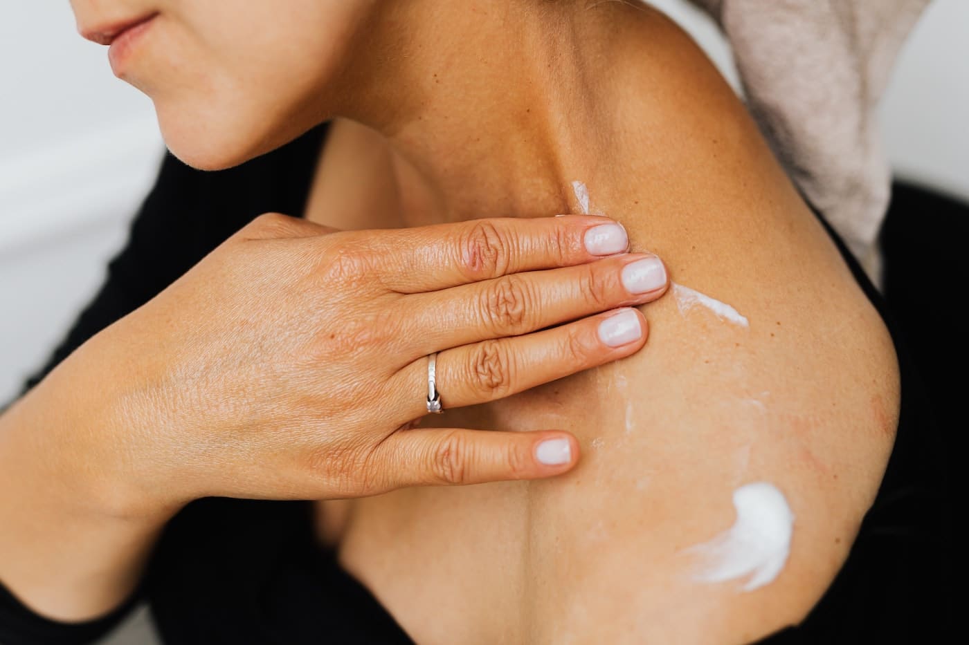 After Sun Body Lotion Creme Sonnenbrand lindern Haut kühlen After Sun Body Lotion Creme Sonnenbrand lindern Haut kühlen